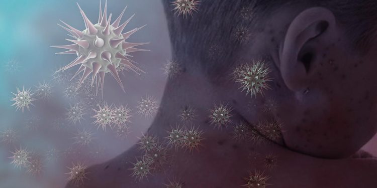 Nijerya'da kızamık salgını: 19 çocuk hayatını kaybetti