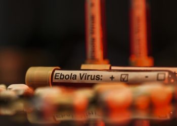 Ebola mücadelesine Batı’dan bütçe darbesi: Salgın küresel riske dönebilir