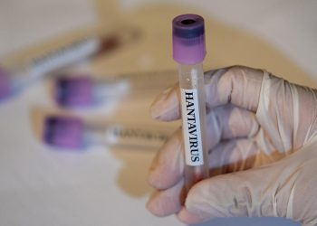 ABD, hantavirüs vakası görülen gemiden vatandaşlarının tahliyesi için uçak gönderecek