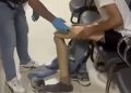 Protez bacağından 830 gram uyuşturucu çıktı