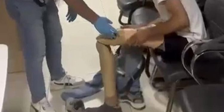 Protez bacağından 830 gram uyuşturucu çıktı