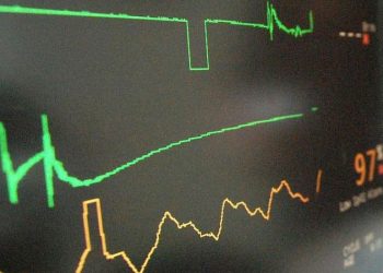 Sadık Sözlü’nün ölüm nedeni “kalp damar hastalığı”