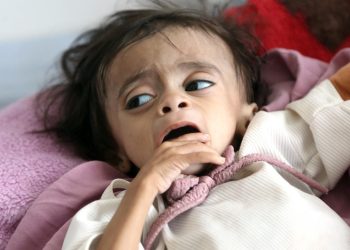 BM’den Yemen’de insani kriz uyarısı
