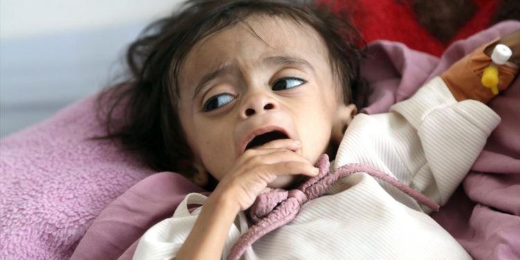 BM’den Yemen’de insani kriz uyarısı
